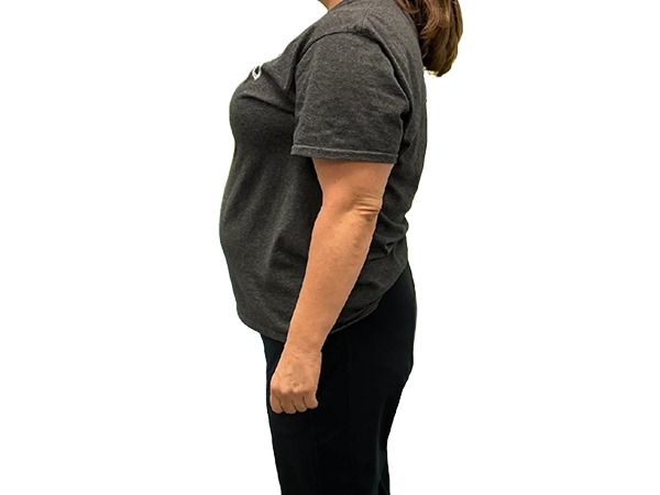 Raleigh Weight Loss Center | Raleigh, NC